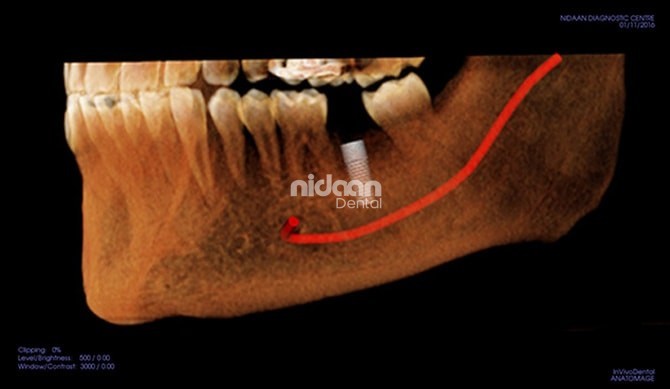 3D Imaging (CBCT)