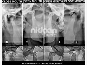 Best Dental X Ray Centre Pune
